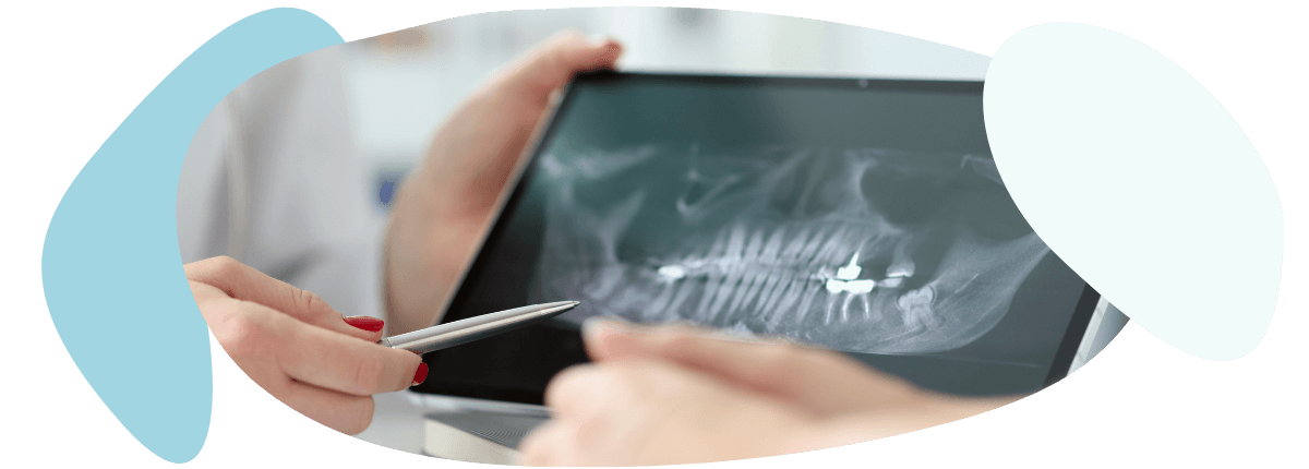 Försäkringskassans bidragssystem för tandvård